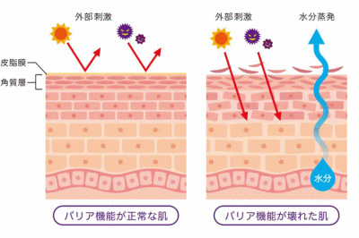 皮膚のバリア機能