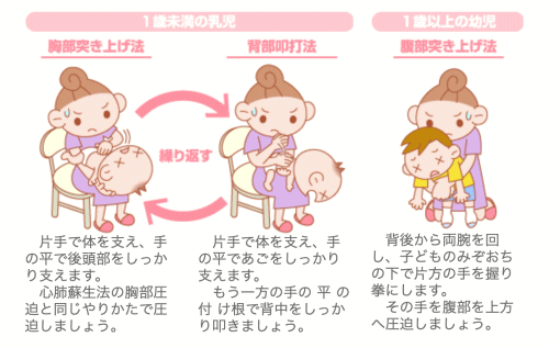 誤飲による窒息の緊急対応