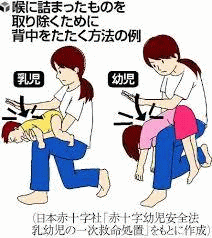 誤飲したものを取り除く方法イラスト
