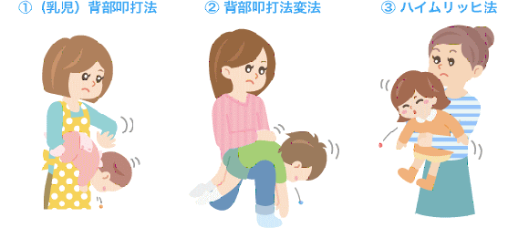 咽頭異物対処法