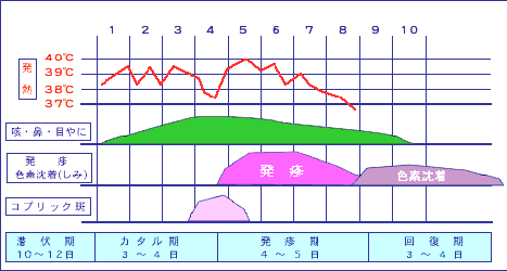 麻疹について